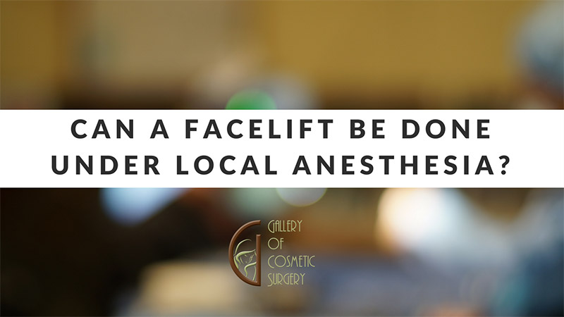 Can a Facelift be done under local anesthesia?