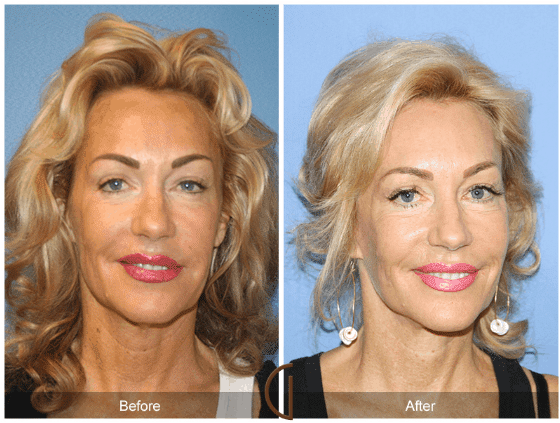Surgery Healing Secrets from Voted Best Cosmetic Surgeon Image