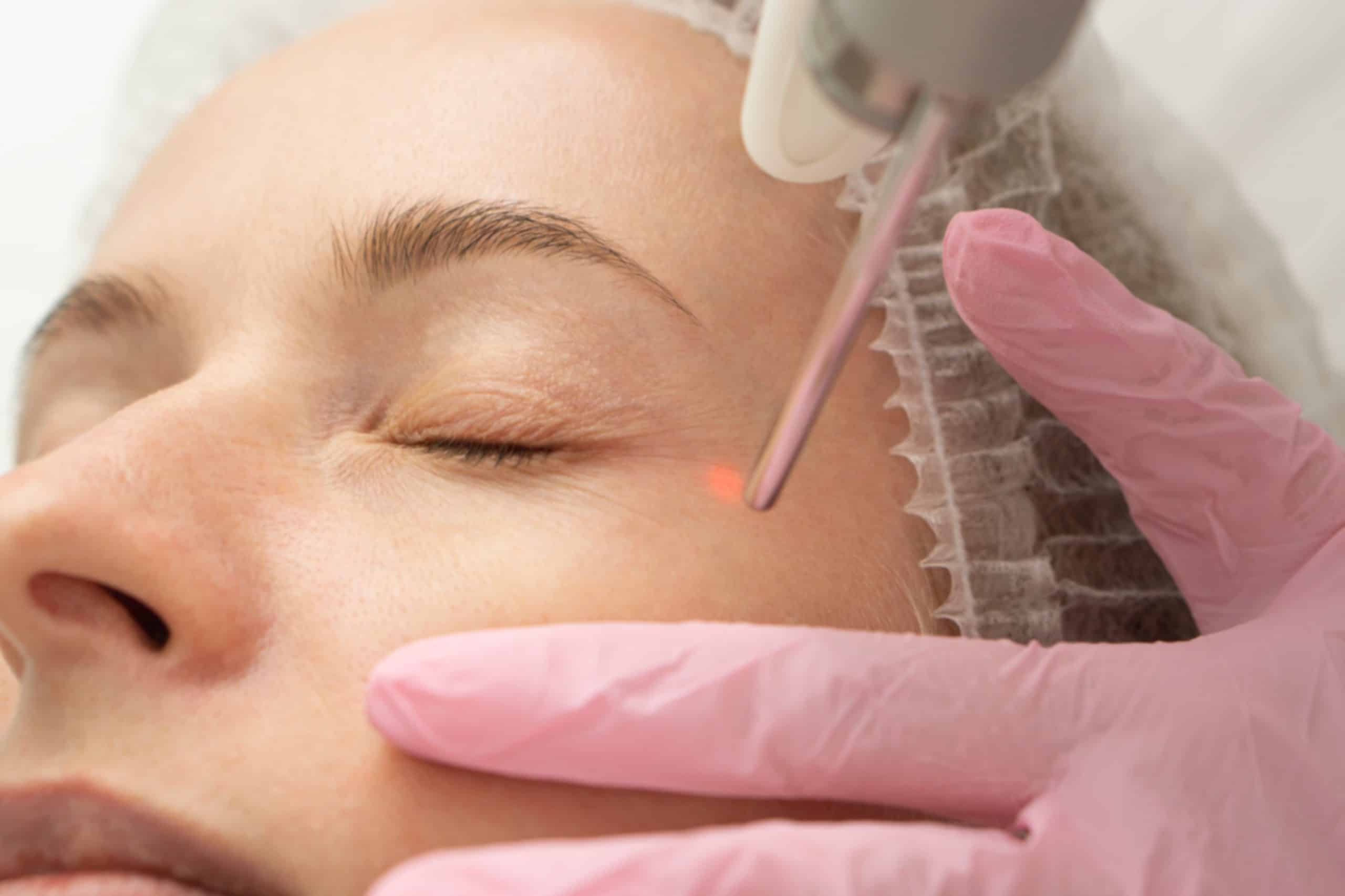 Eye Lid Surgery Orange County: Image