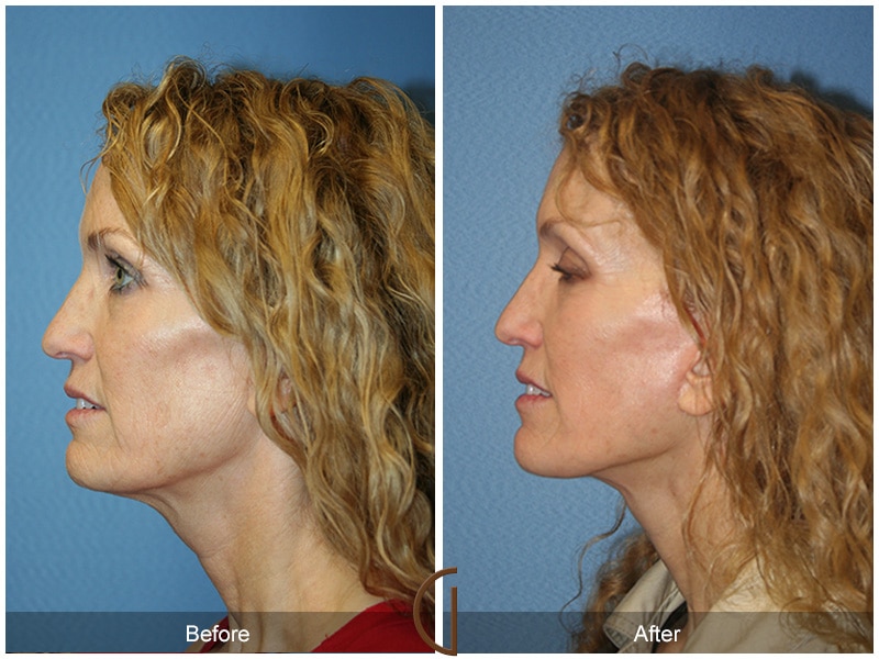 Facelift Alpine CA 58 Image