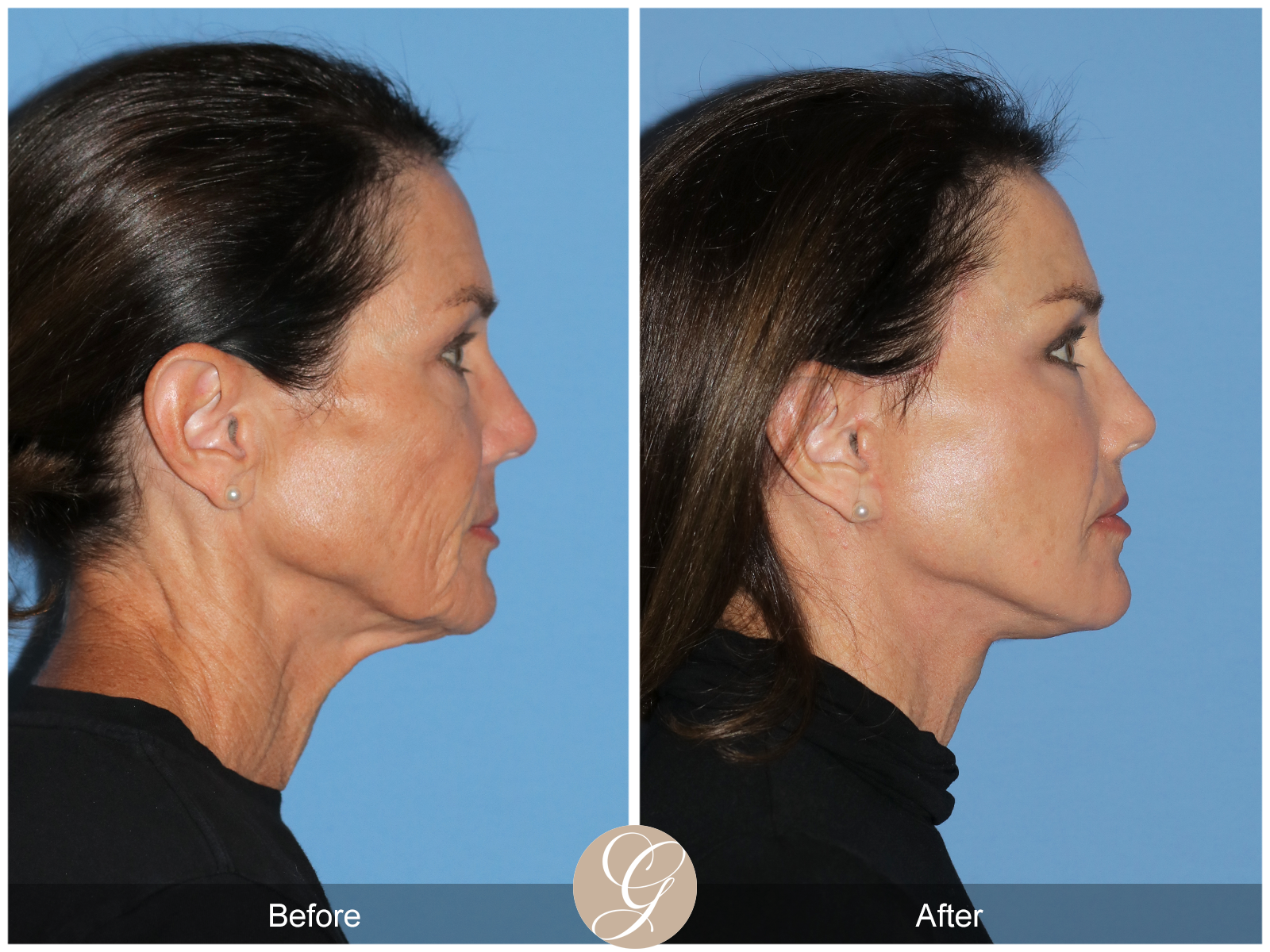 Dr. Kevin Sadati Discusses Emerging Trends in Plastic and Aesthetic Medicine