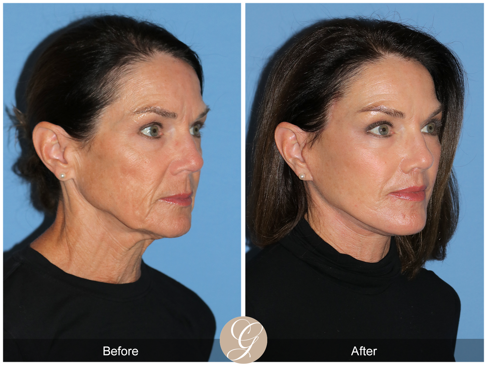 Dr. Kevin Sadati Discusses Emerging Trends in Plastic and Aesthetic Medicine