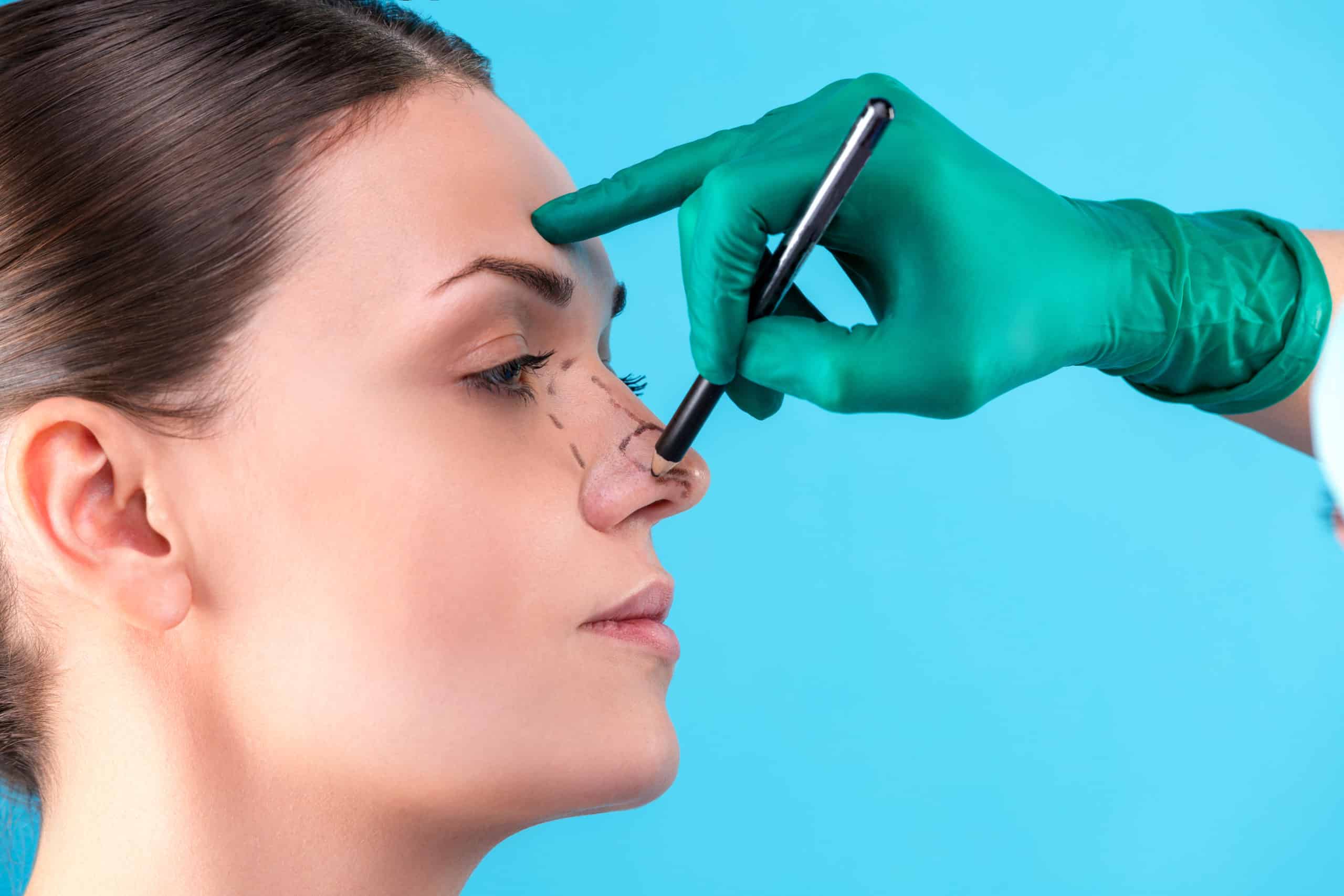 Realistic Changes That Can Be Made During Rhinoplasty Image