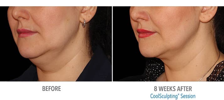 Coolmini Case 2 Image