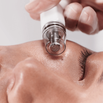 I Tried the Diamond Glow Facial, Here’s How It’s Different From a Hydrafacial Image