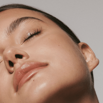 The Pros Say That Your Skin’s Red, Bumpy Patch Might Not Be A Breakout Image