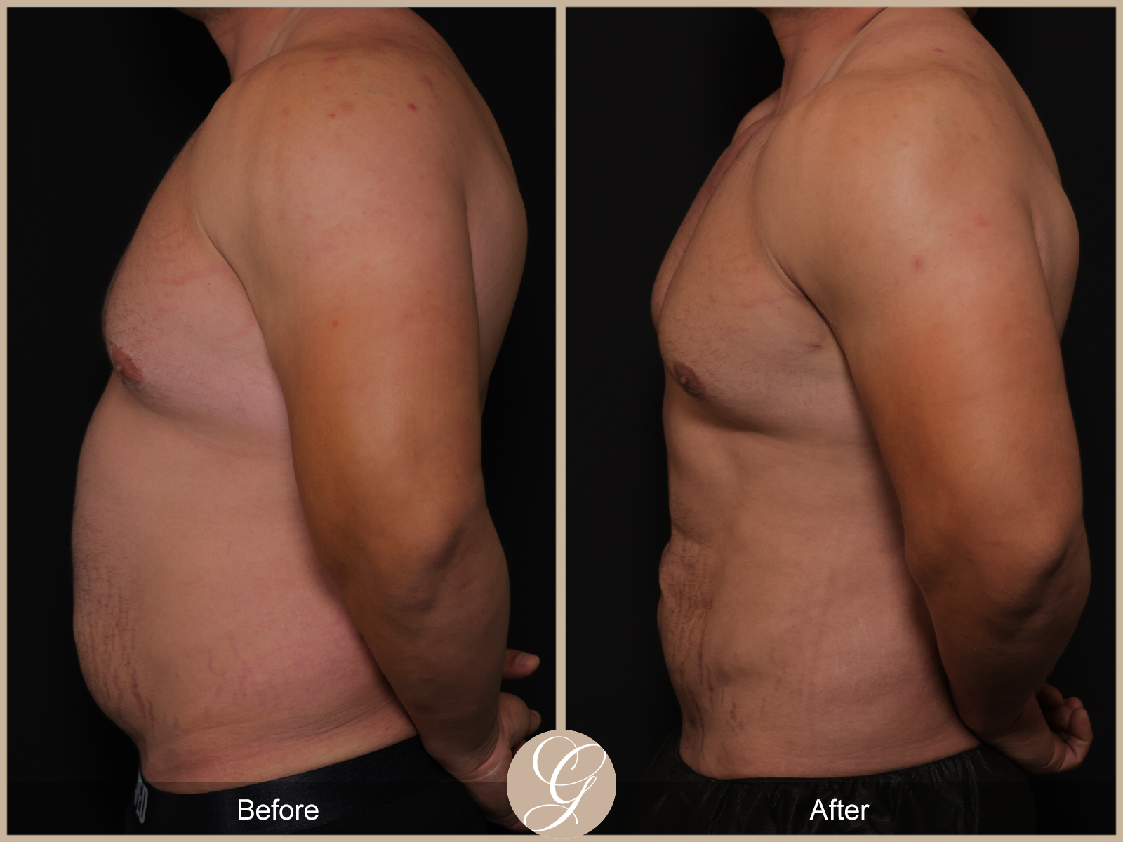 Body by Tehrani Pt 2 Image