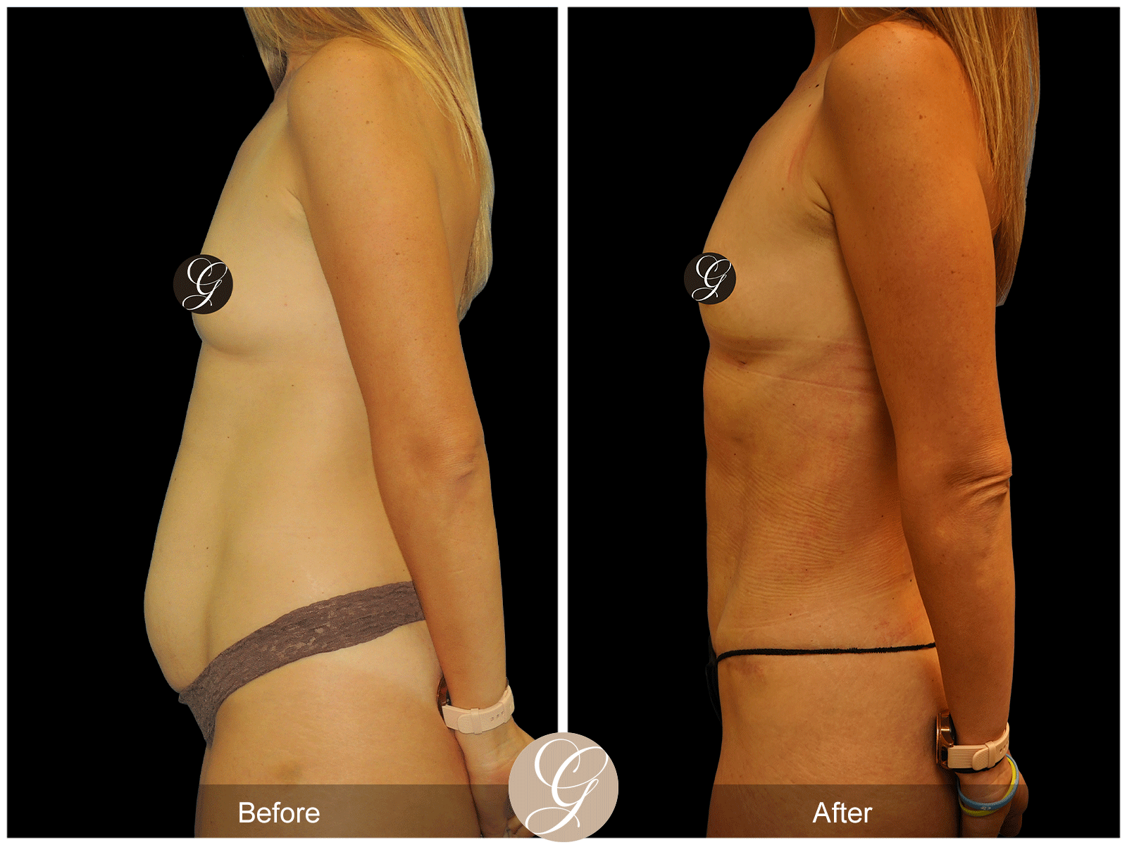 Body by Tehrani Pt 1 Image