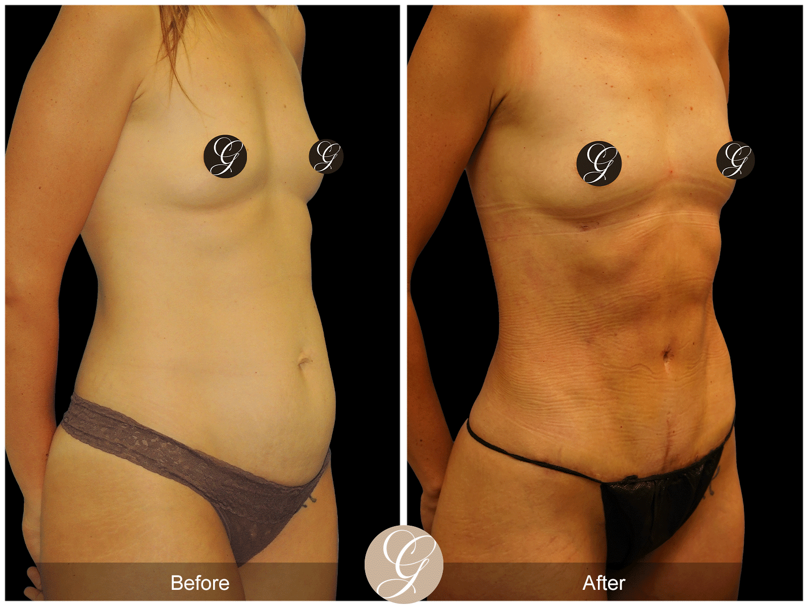 Body by Tehrani Pt 1 Image