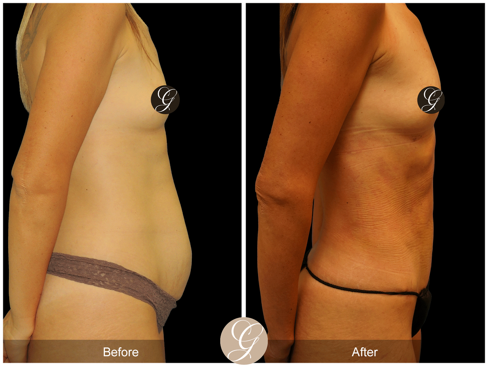 Body by Tehrani Pt 1 Image