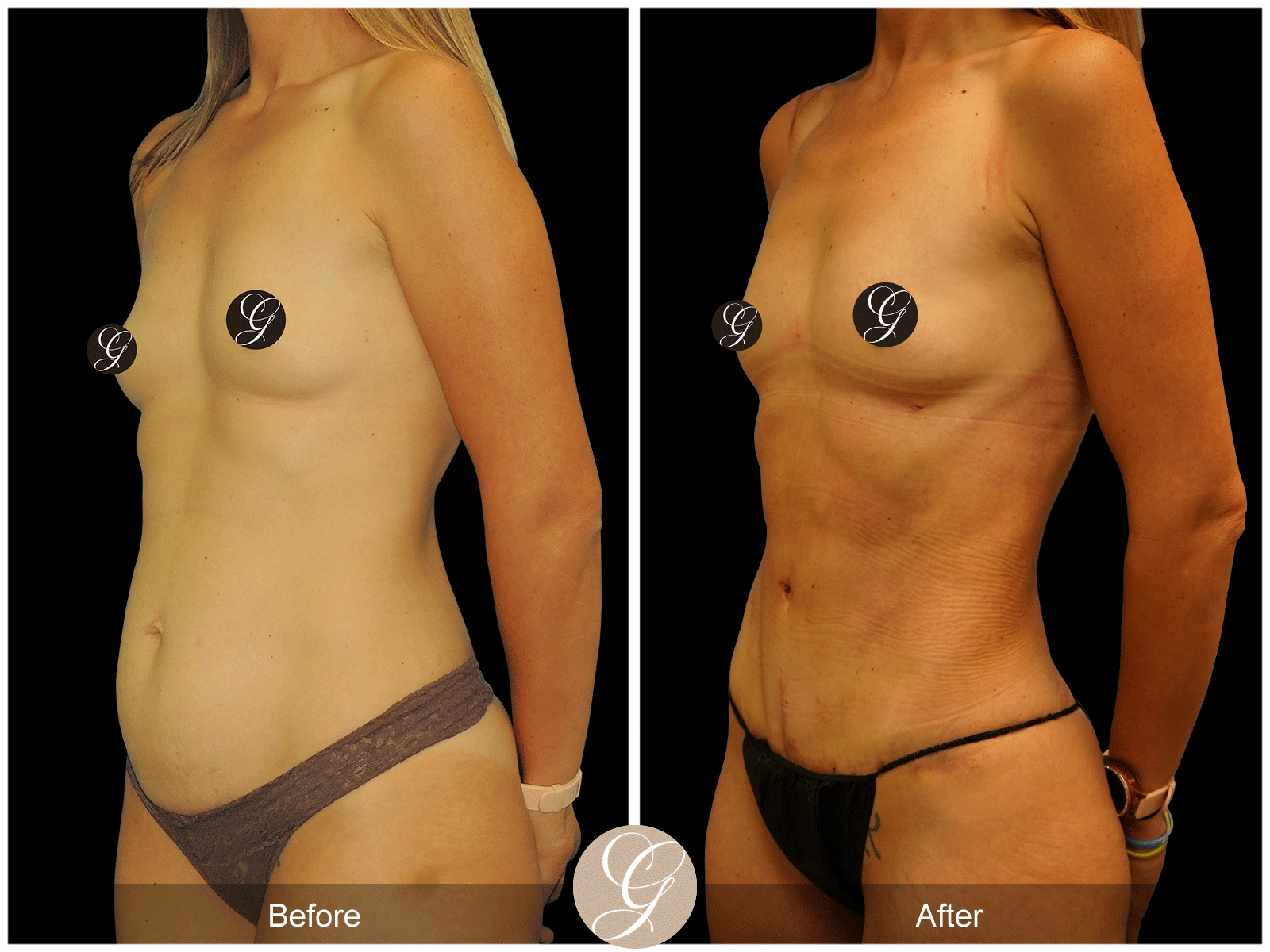 Body by Tehrani Pt 1 Image