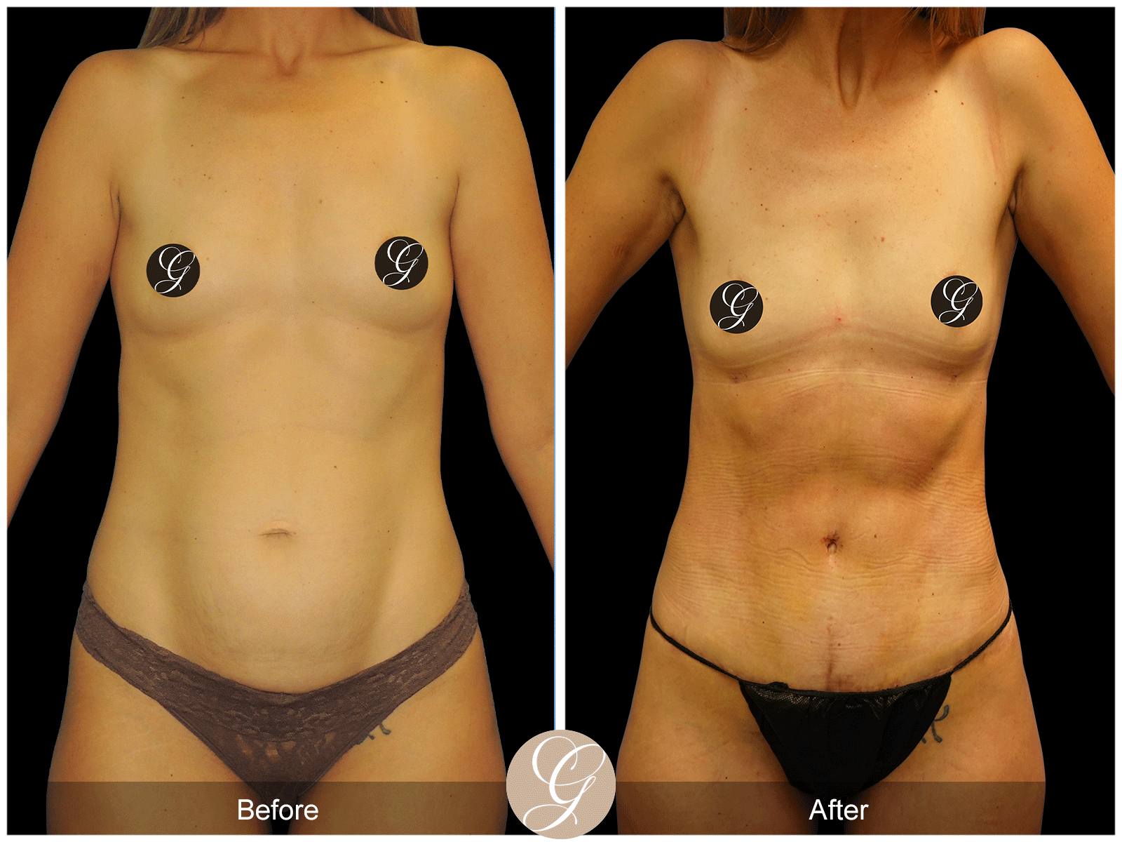 Body by Tehrani Pt 1 Image