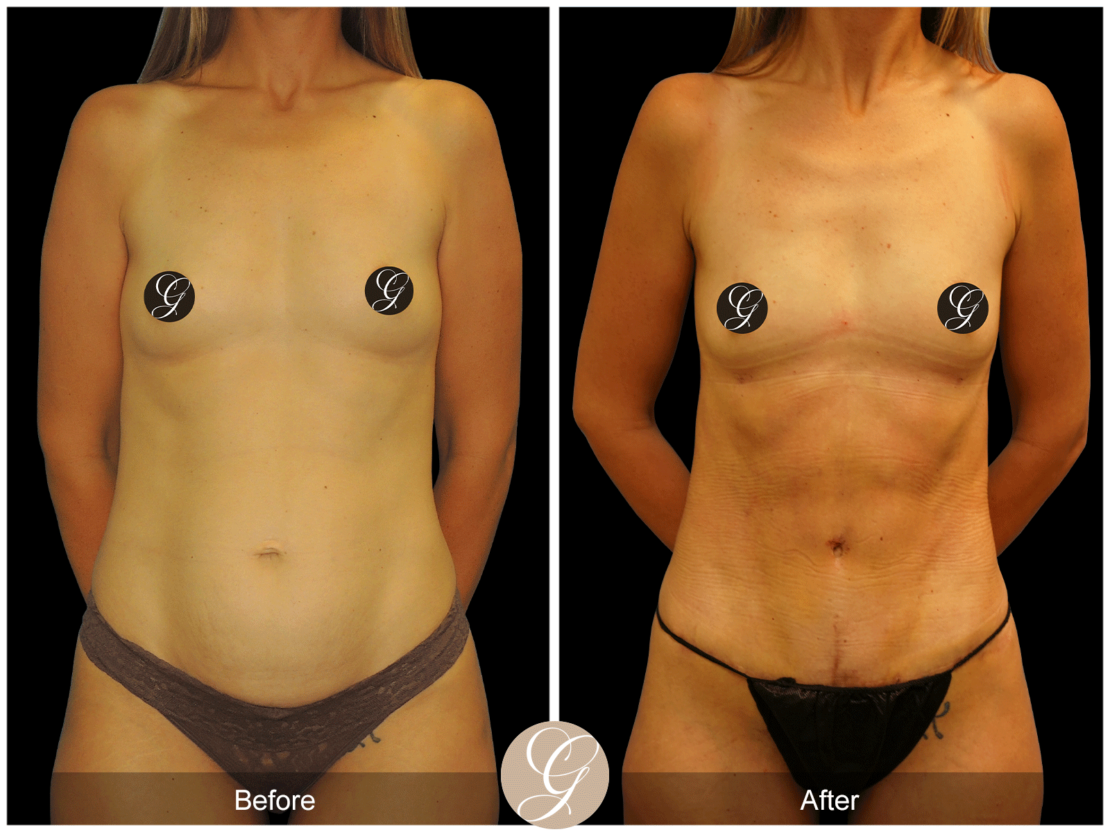 Body by Tehrani Pt 1 Image