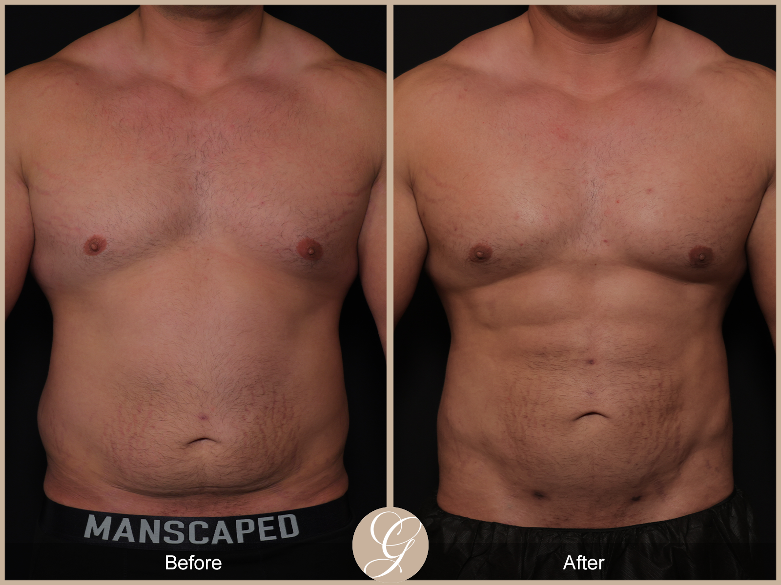 Body by Tehrani Pt 2 Image