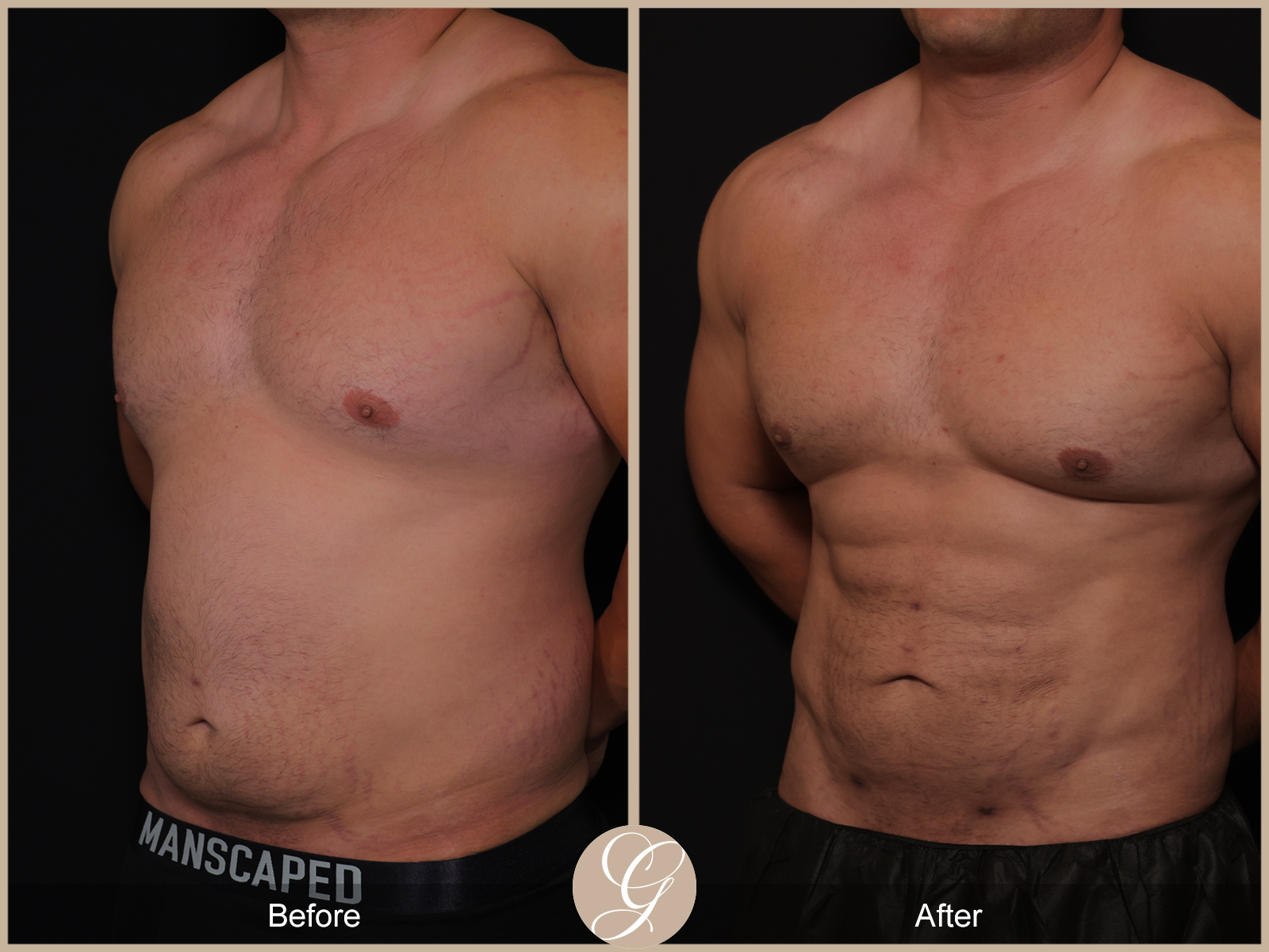 Body by Tehrani Pt 2 Image