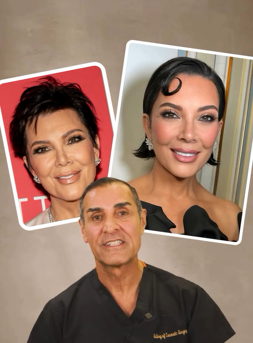 Kris Jenner’s Facelift Results: What’s Real and What’s Not Image